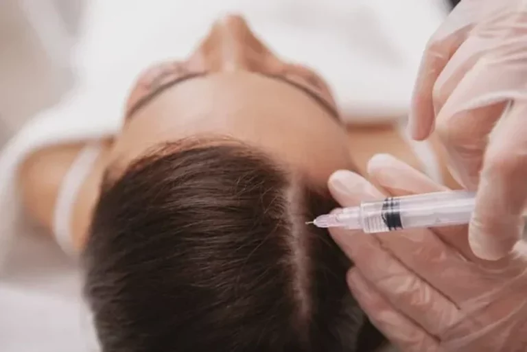Should Clinics Start Investing In PRP Hair Treatment For Hair Loss