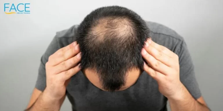 Sparse hair and bald head problem on a grey background