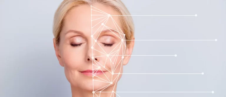 A woman's face with lines indicating treatment areas