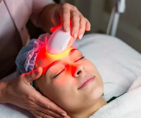 Intense Pulsed Light (IPL)