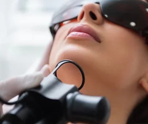 Laser Resurfacing