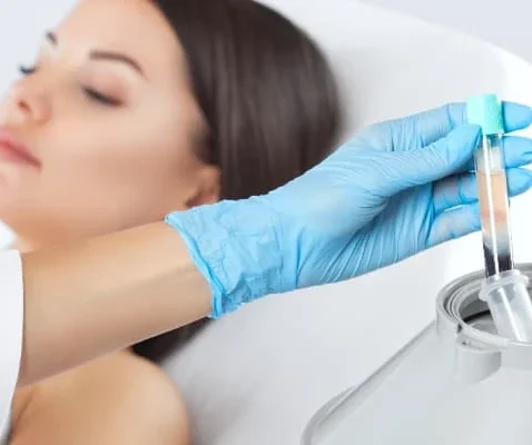 Platelet-Rich Plasma (PRP) And Platelet-Rich Fribin (PRF) Therapy