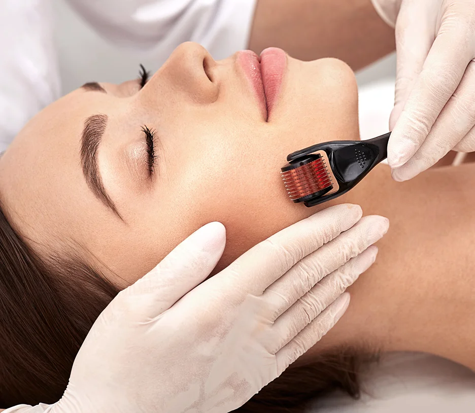 derma roller 