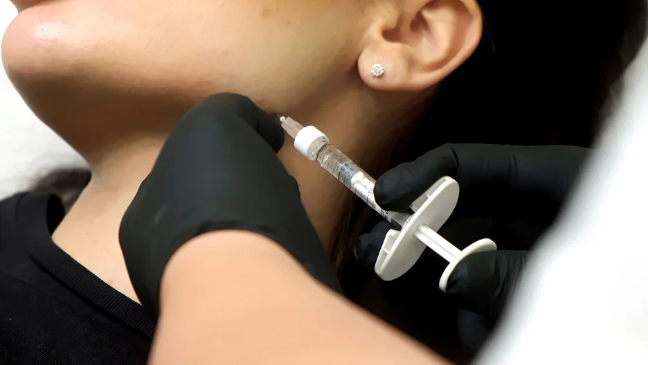 a woman recieved pdrn mesotherapy treatment